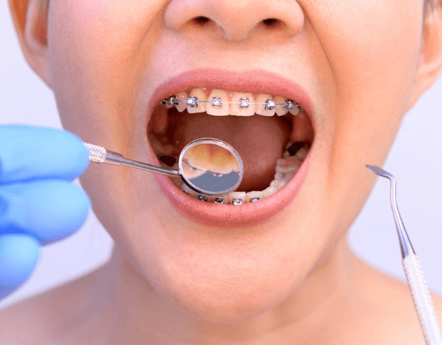 Kieferorthopädische Instrumente