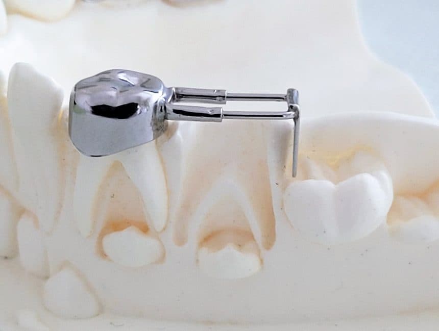 Platzhalter für frühzeitig verlorene Milchzähne