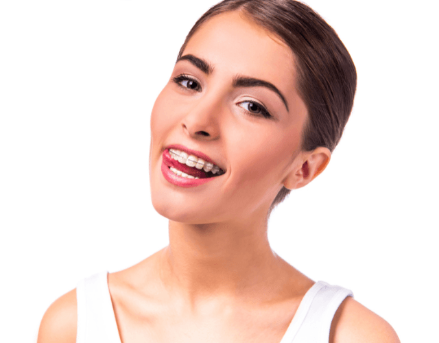 Young woman showing her smile with braces