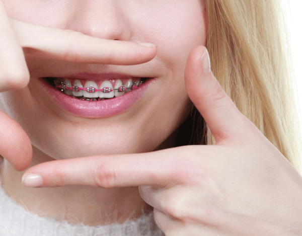 Teenager with braces smiling