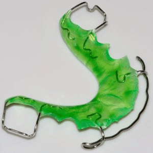 Herausnehmbarer Retainer (Hawley-Typ) aus grünem Kunststoff mit Labialbogen und Klammern