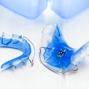 Two blue removable plates with expansion screw and retaining clasps